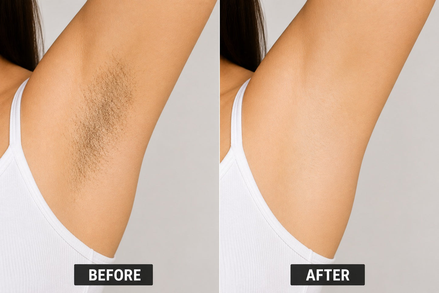Instant Hair Removal Mousse – Silky Smooth Skin