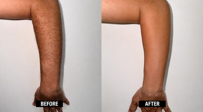 Instant Hair Removal Mousse – Silky Smooth Skin