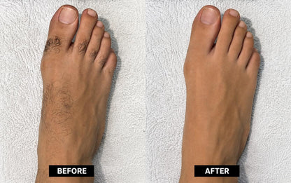 Instant Hair Removal Mousse – Silky Smooth Skin