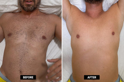 Instant Hair Removal Mousse – Silky Smooth Skin